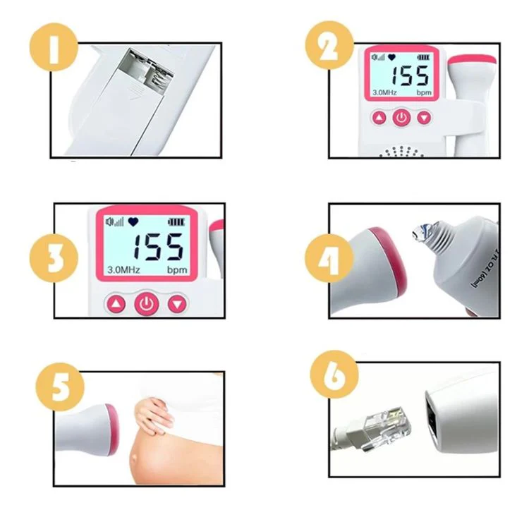 Fetal Doppler Heart Rate Monitor with LCD Display - Image 12