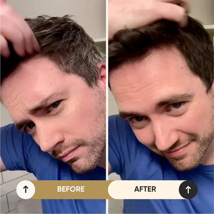 Hair Dye Shampoo - Fast No-Damage Color Treatment - Image 11