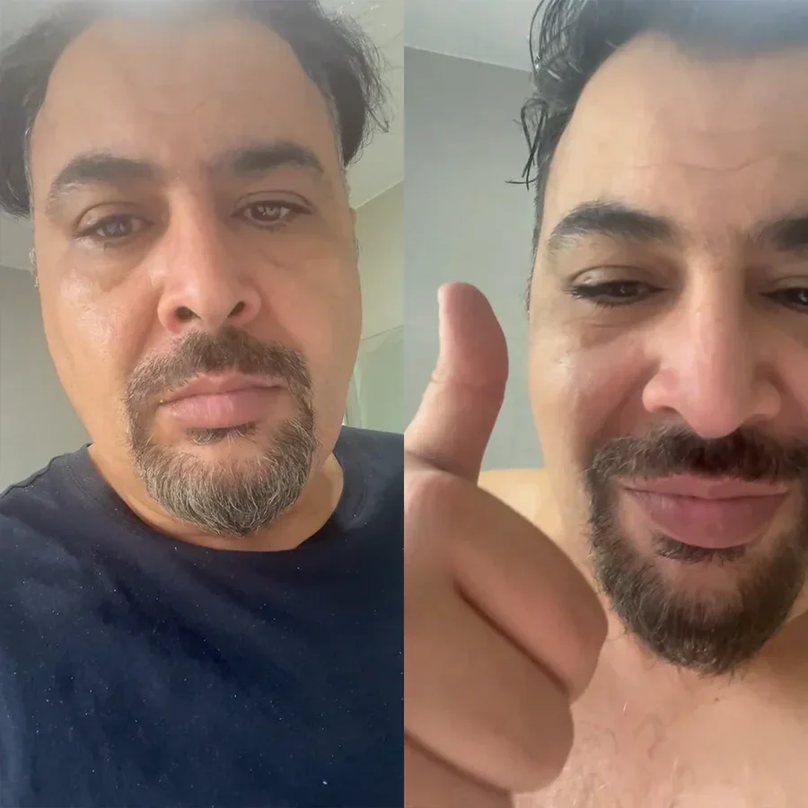 Hair Dye Shampoo - Fast No-Damage Color Treatment - Image 9