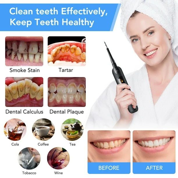 Teeth Cleaner | Waterproof Electric Scaler Tool for Home - Image 6